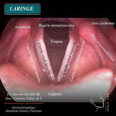 cuerdas vocales